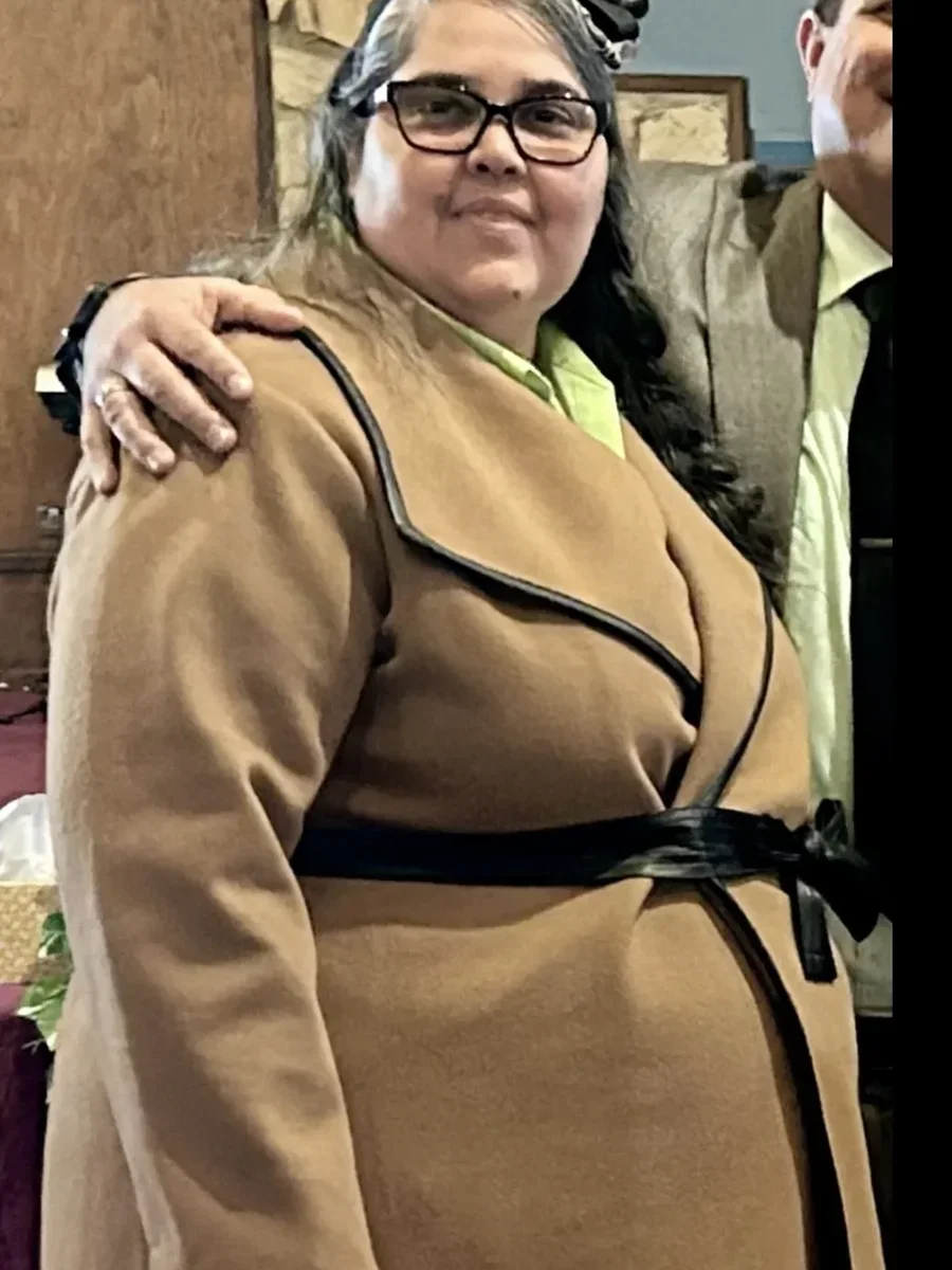 Dr. Baptista bariatric patient 89 before and after weight loss - Before