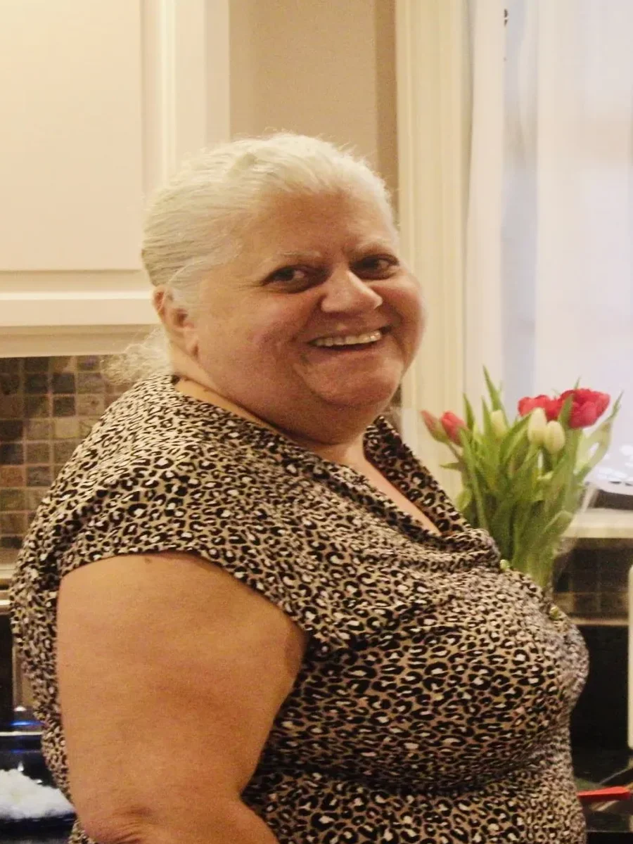 Dr. Baptista bariatric patient 91 before and after weight loss - Before