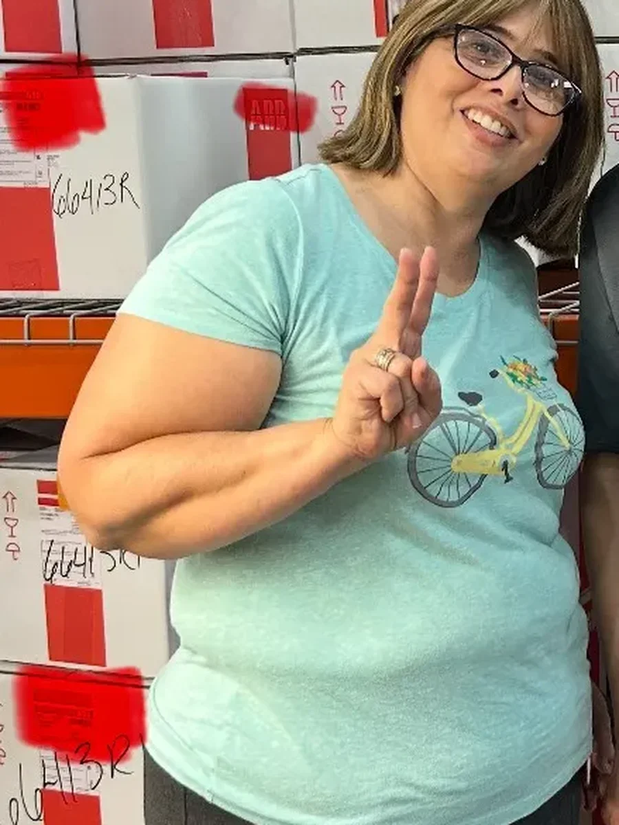 Dr. Baptista bariatric patient 93 before and after weight loss - Before