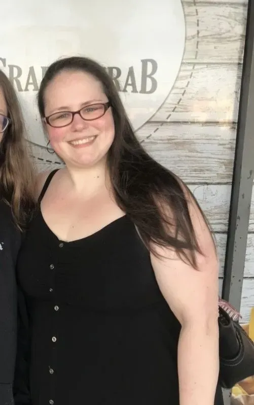 Before weight loss surgery