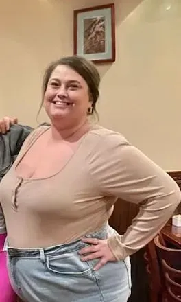 Before weight loss surgery