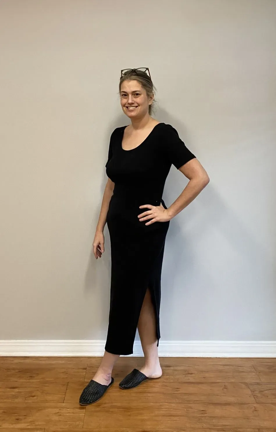 After weight loss surgery