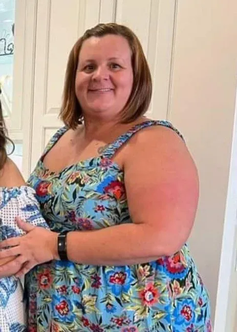 Before weight loss surgery