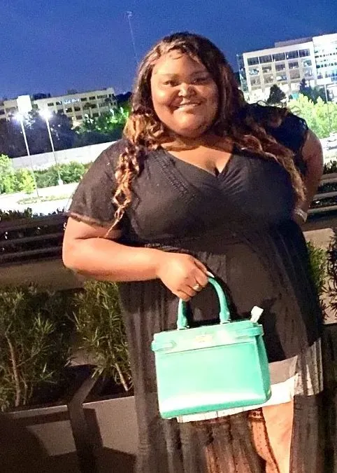 Before weight loss surgery