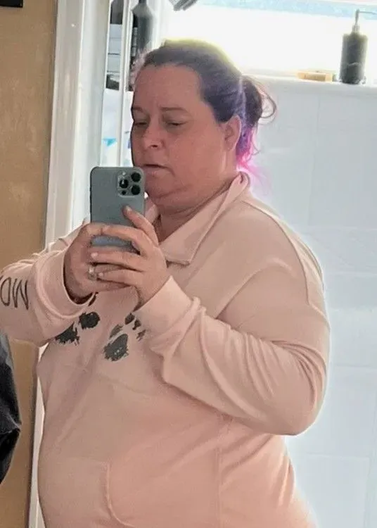 Before weight loss surgery