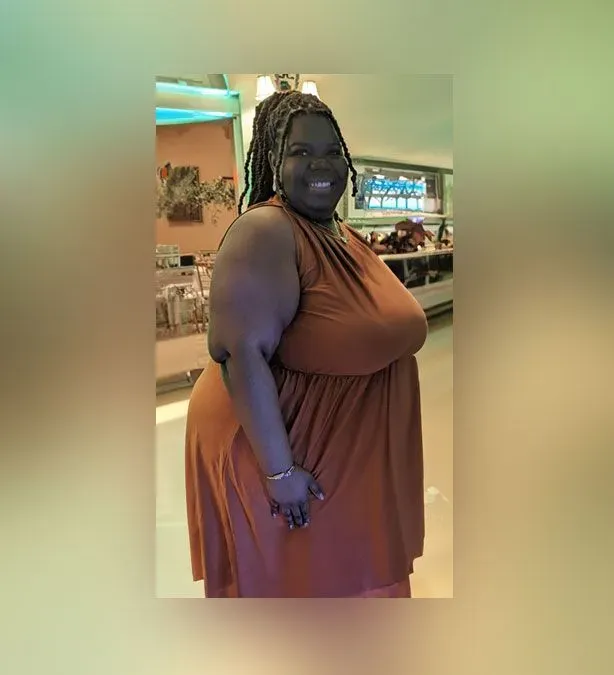 Before weight loss surgery