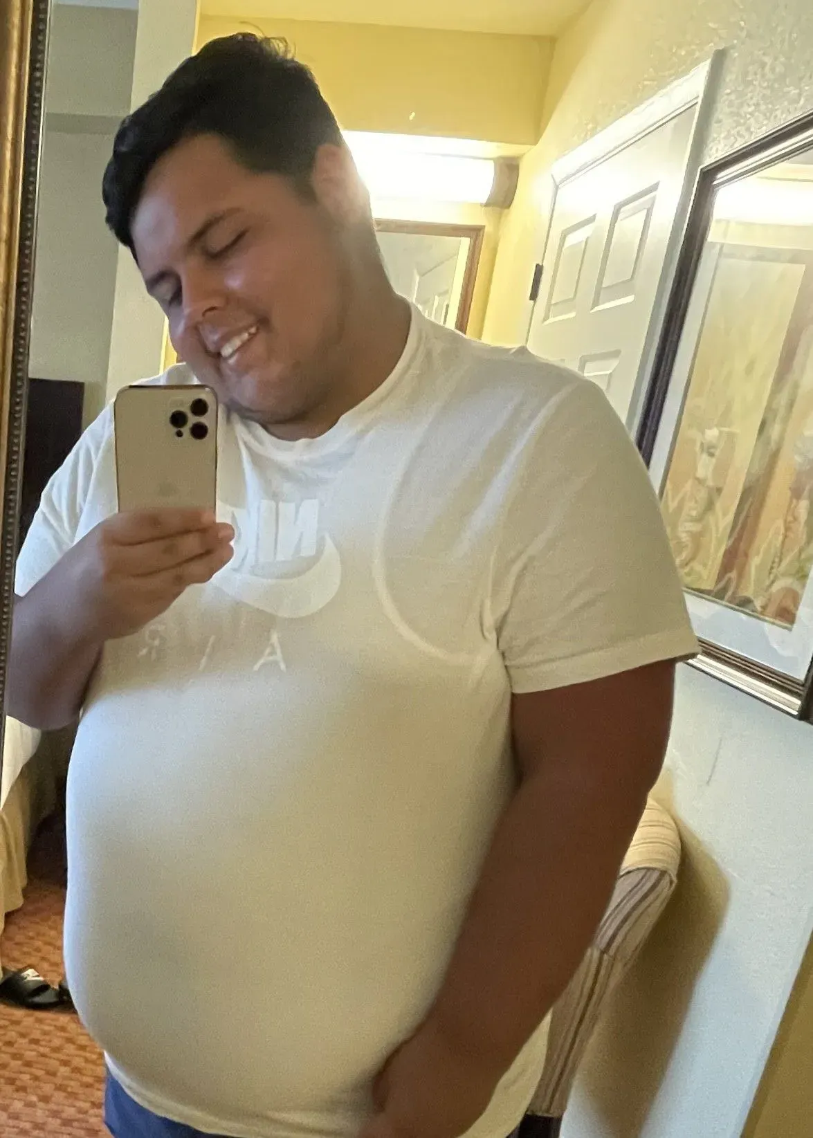 Before weight loss surgery