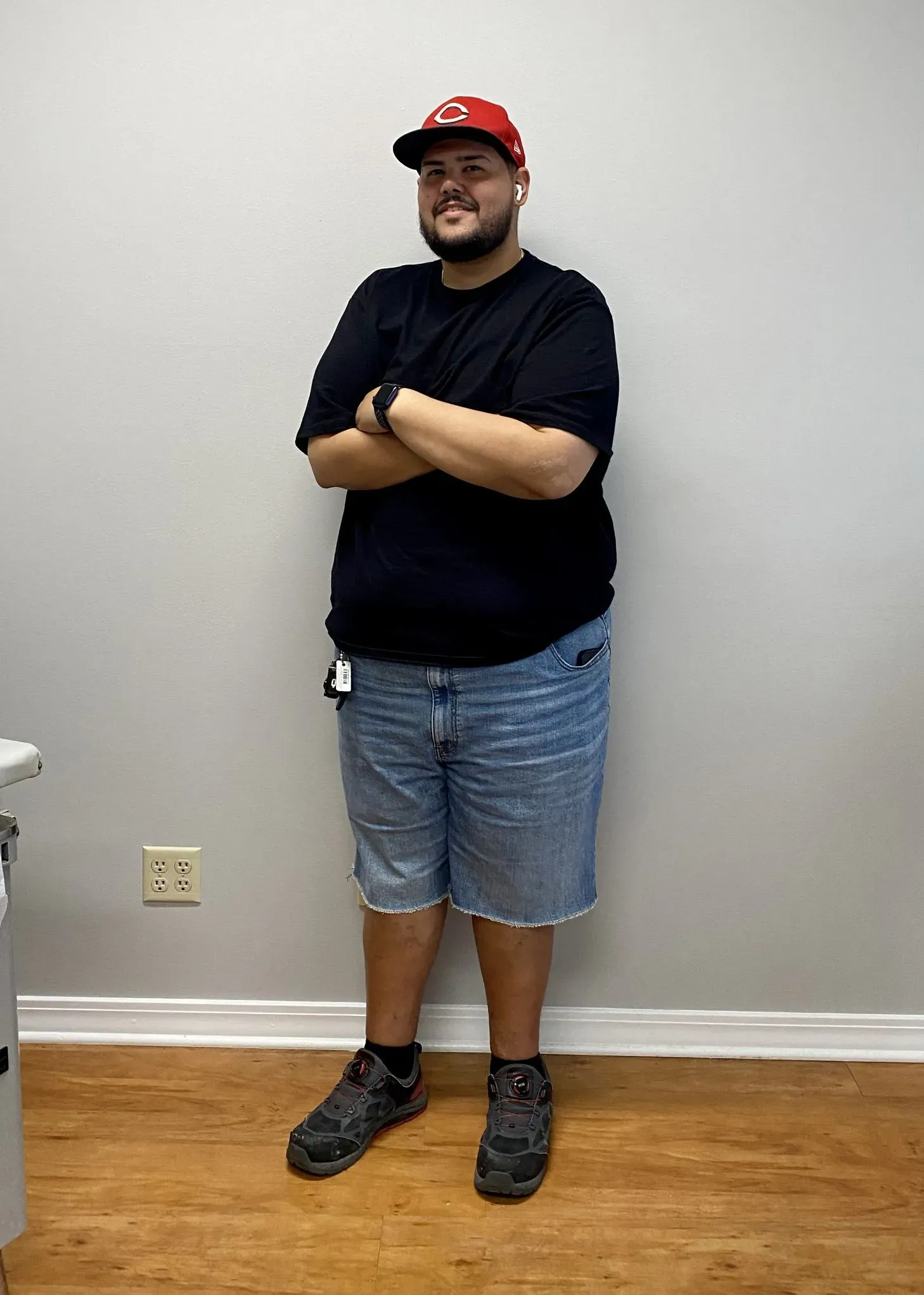 After weight loss surgery