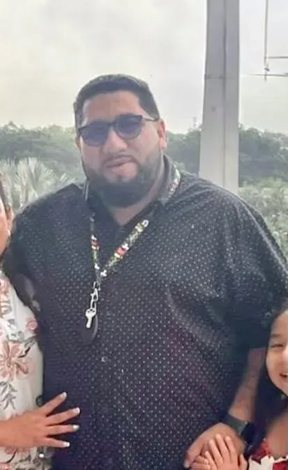 Before weight loss surgery