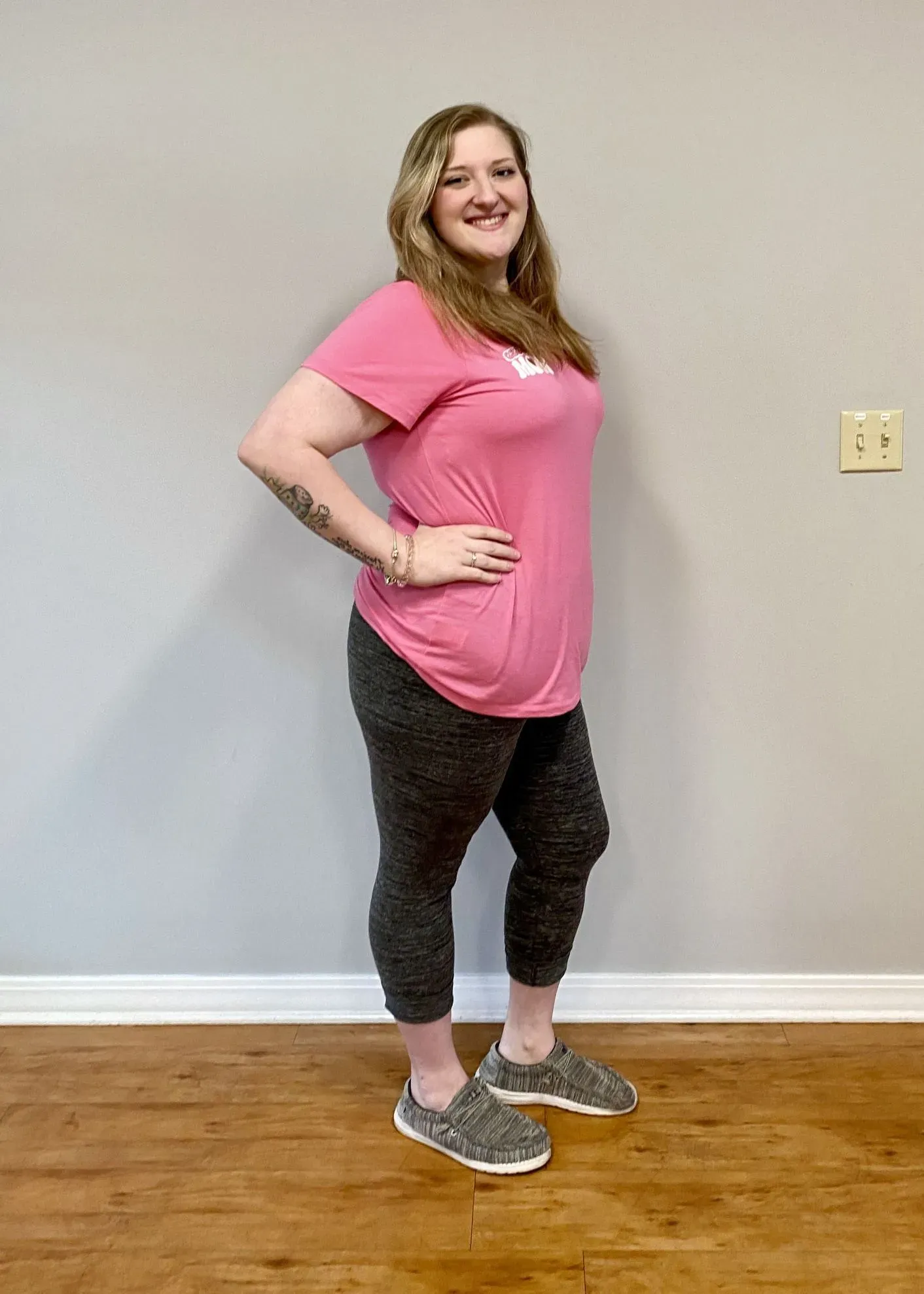 After weight loss surgery