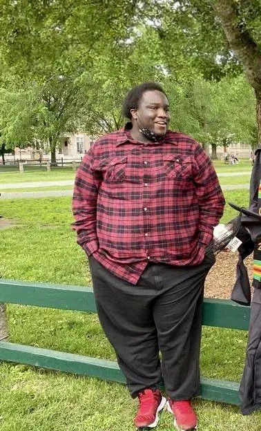 Before weight loss surgery