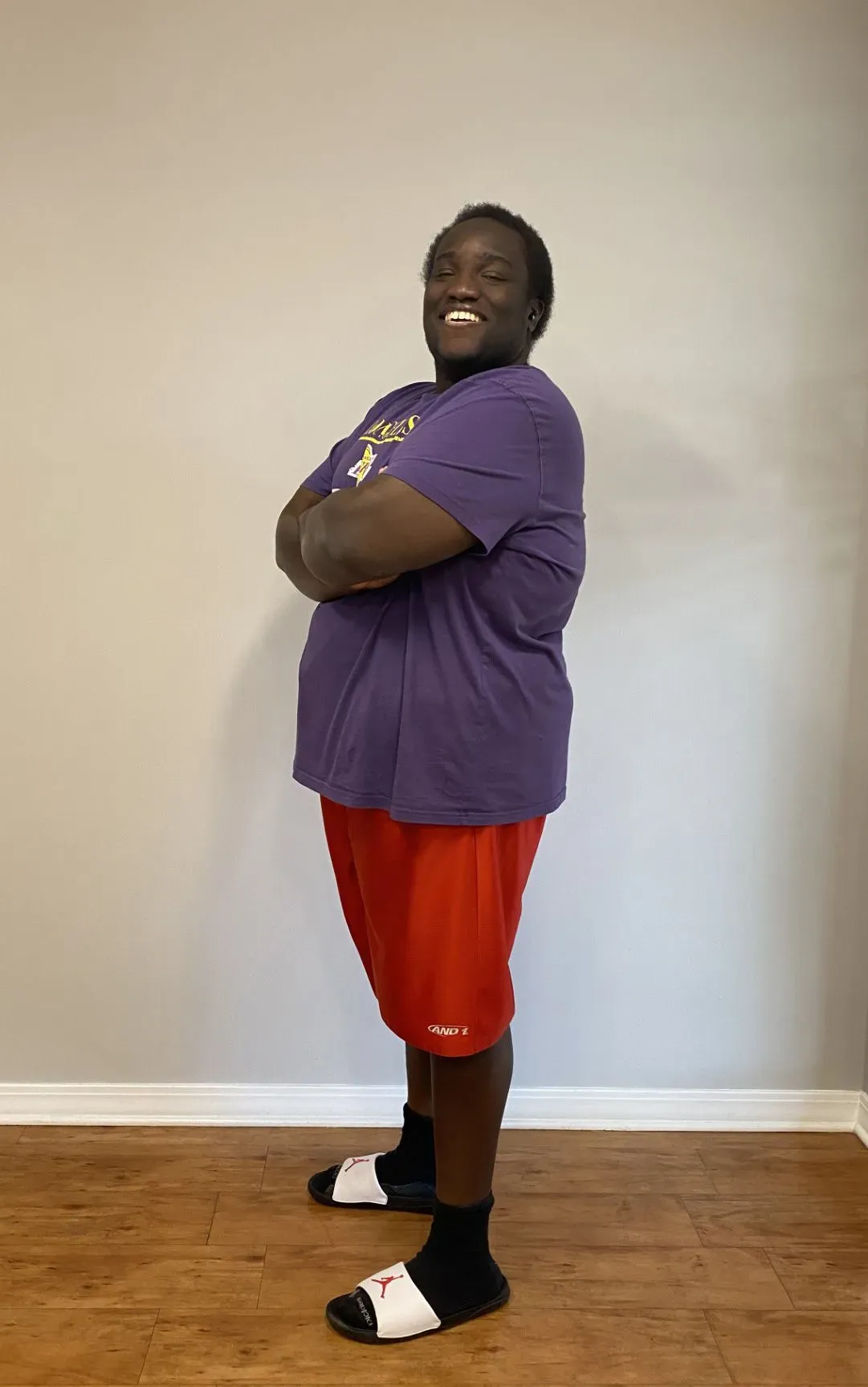 After weight loss surgery