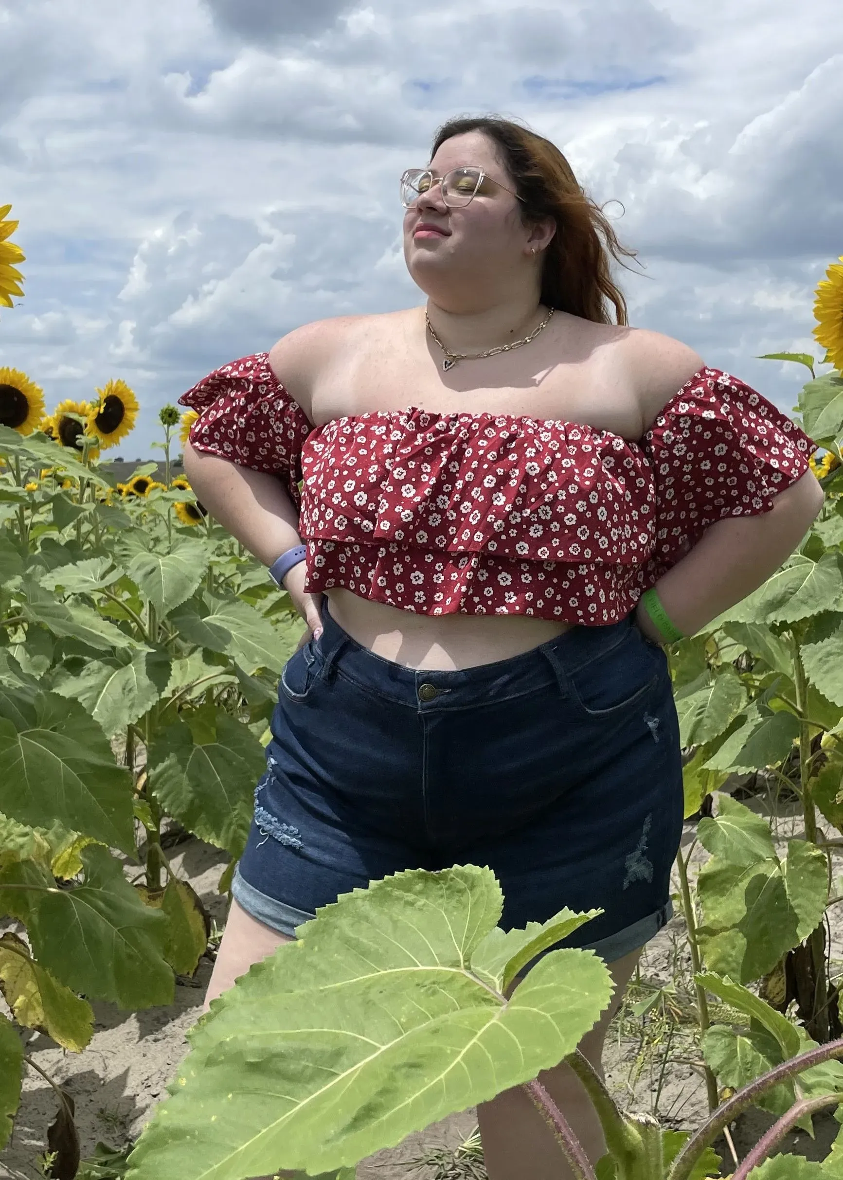 Before weight loss surgery