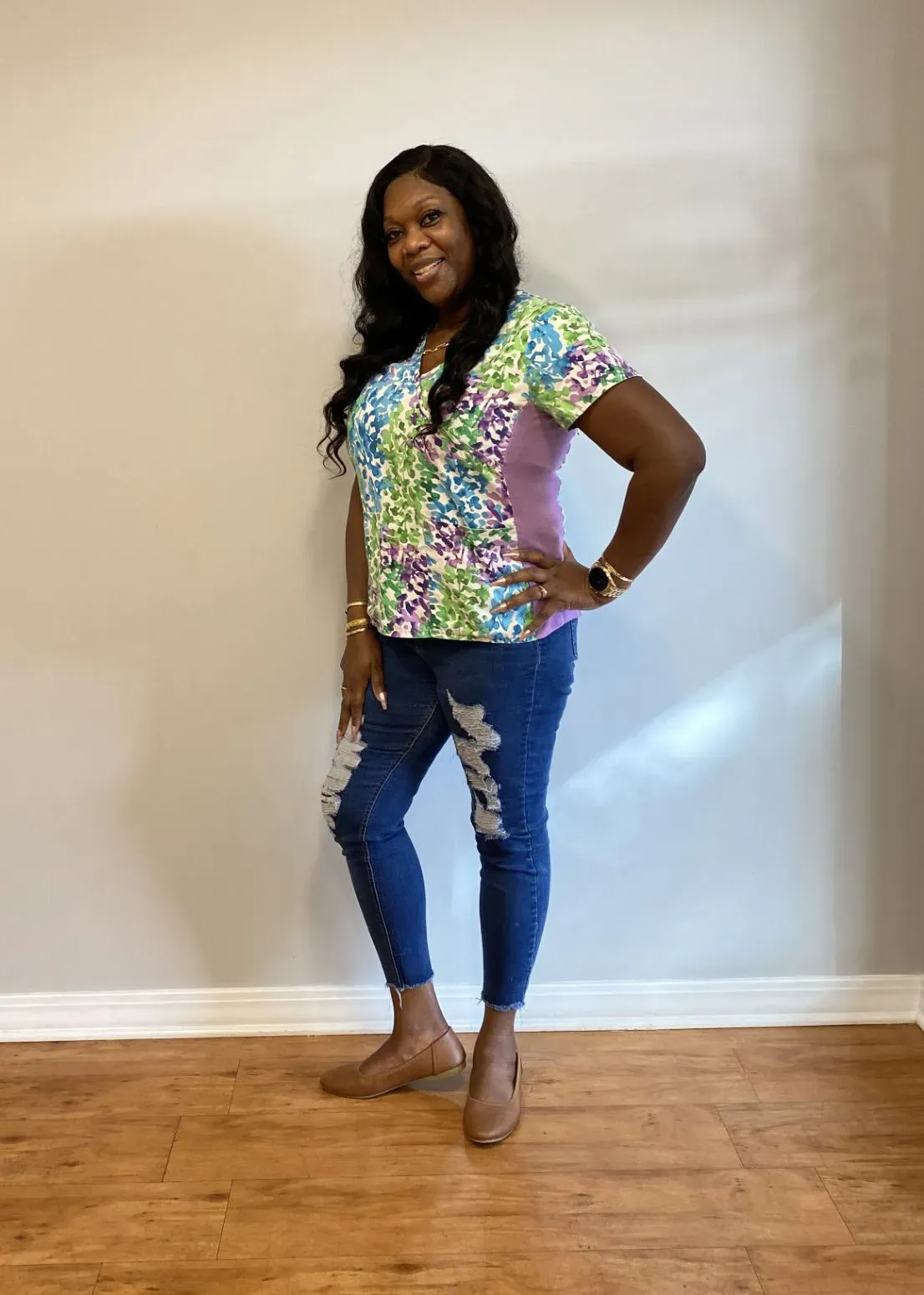 After weight loss surgery