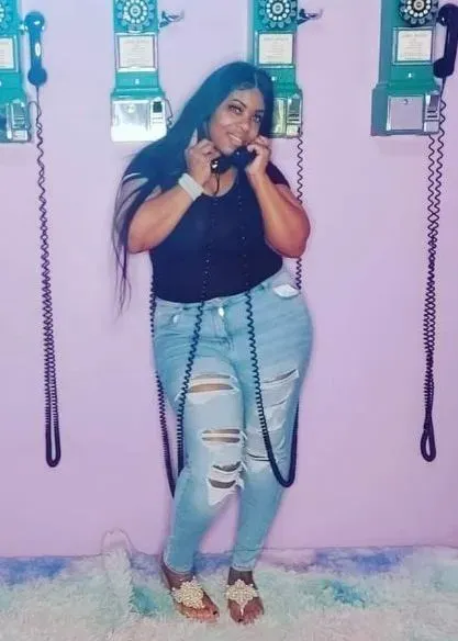 Before weight loss surgery