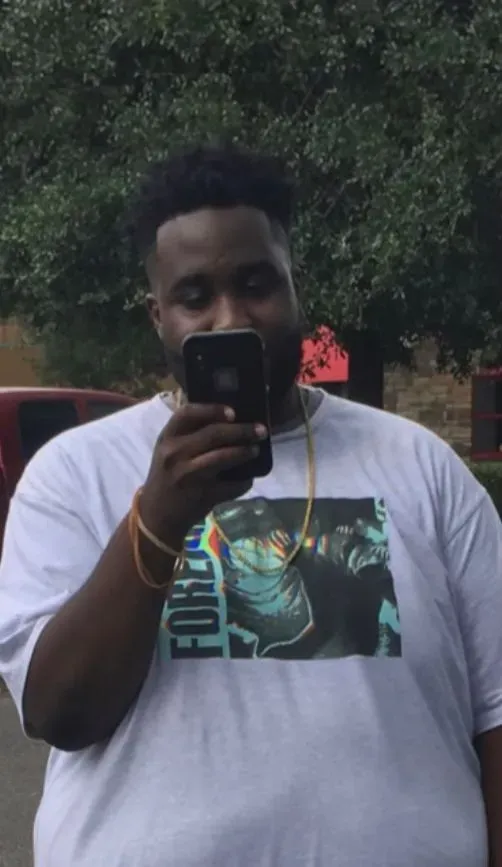 Before weight loss surgery