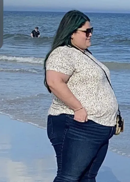 Before weight loss surgery