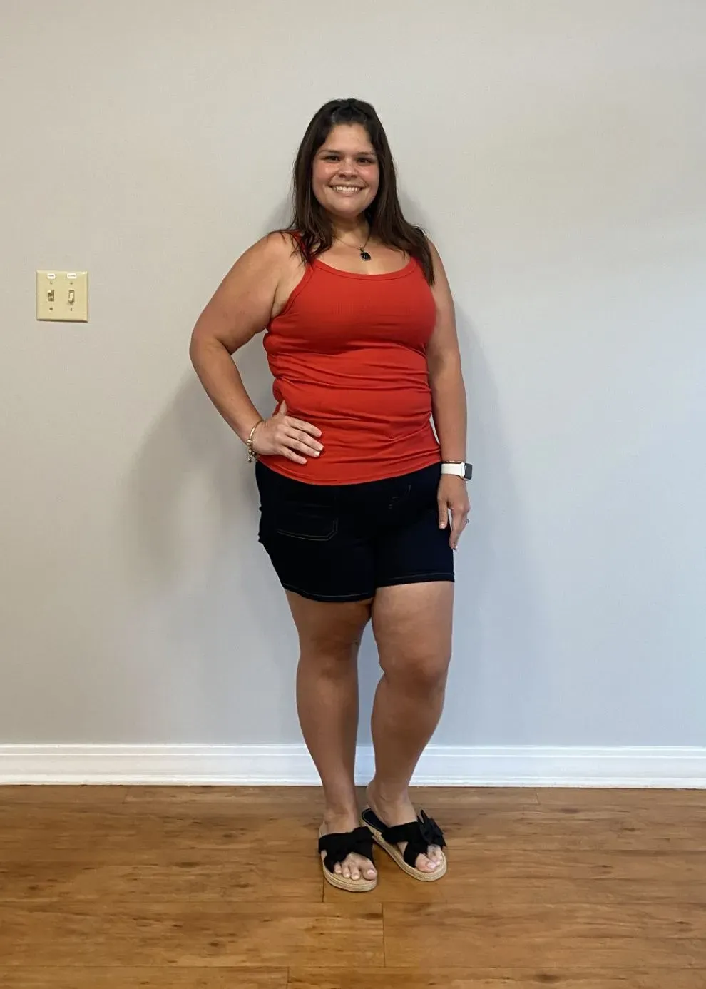 After weight loss surgery