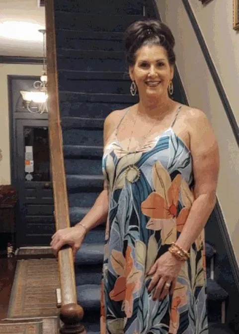 Before weight loss surgery