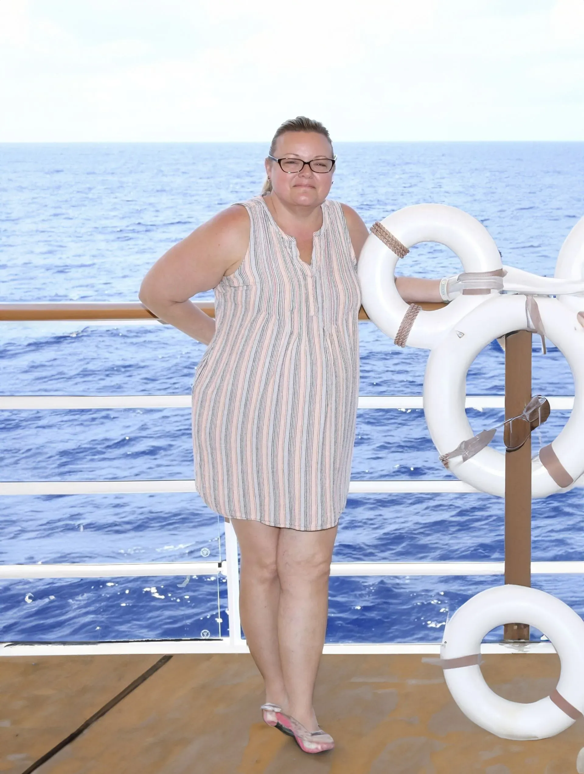 Before weight loss surgery