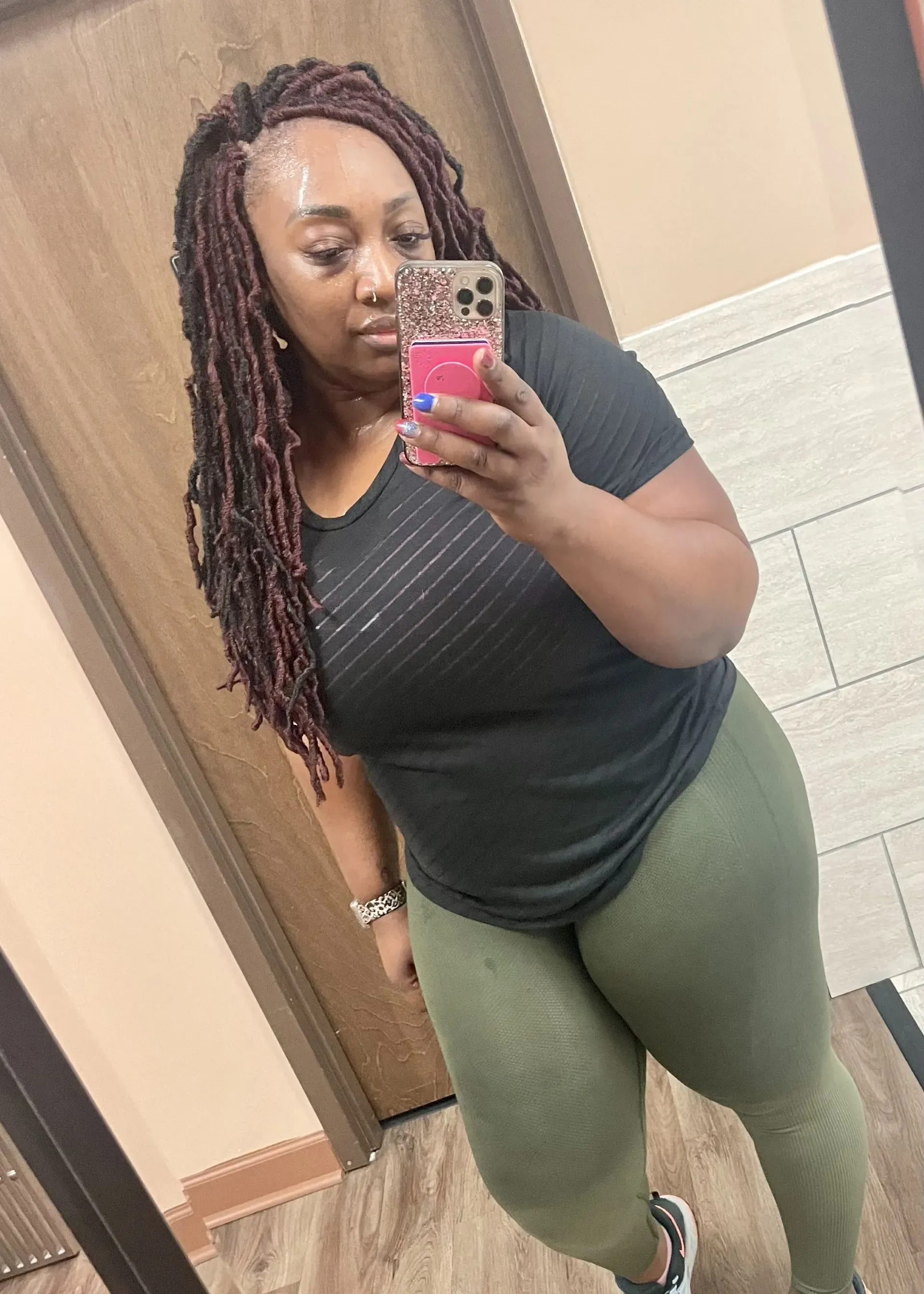 Before weight loss surgery