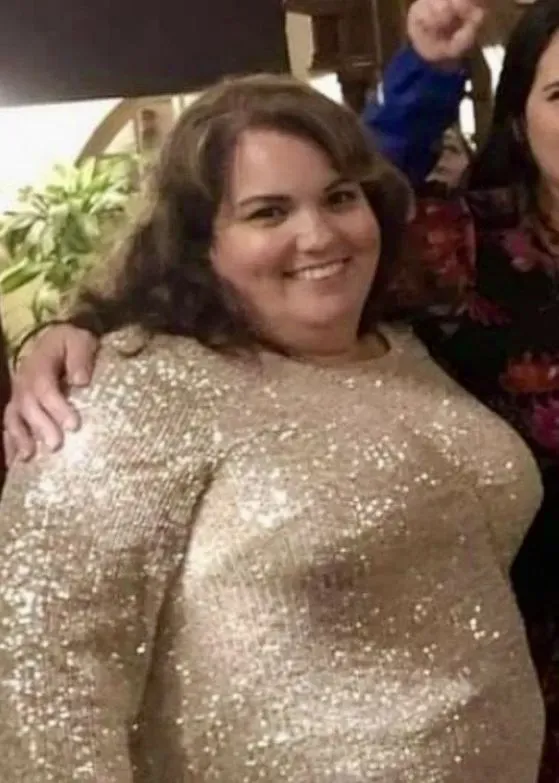 Before weight loss surgery