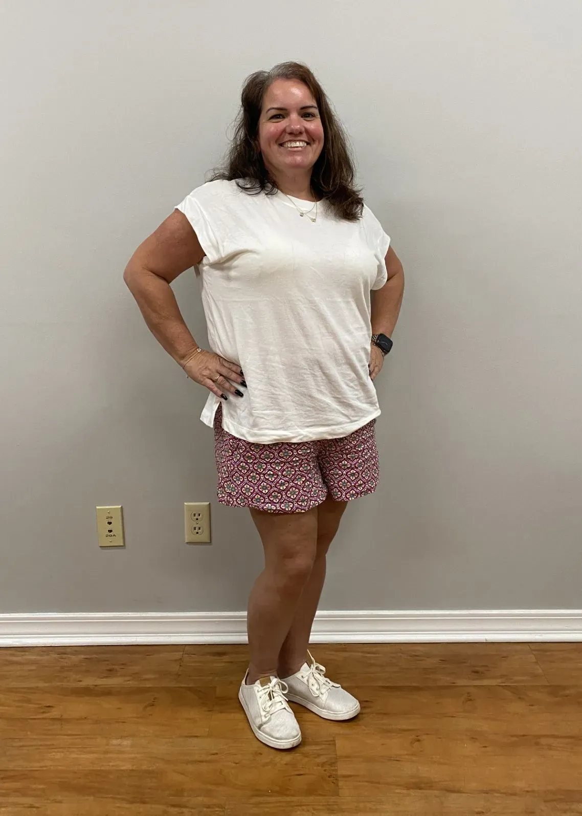 After weight loss surgery