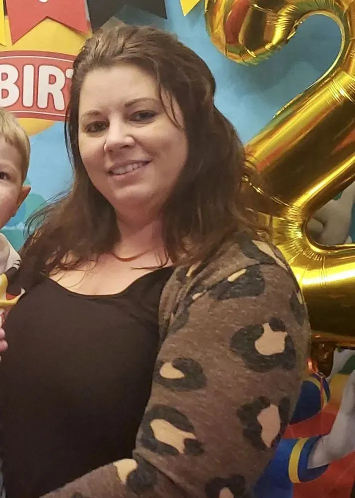 Before weight loss surgery