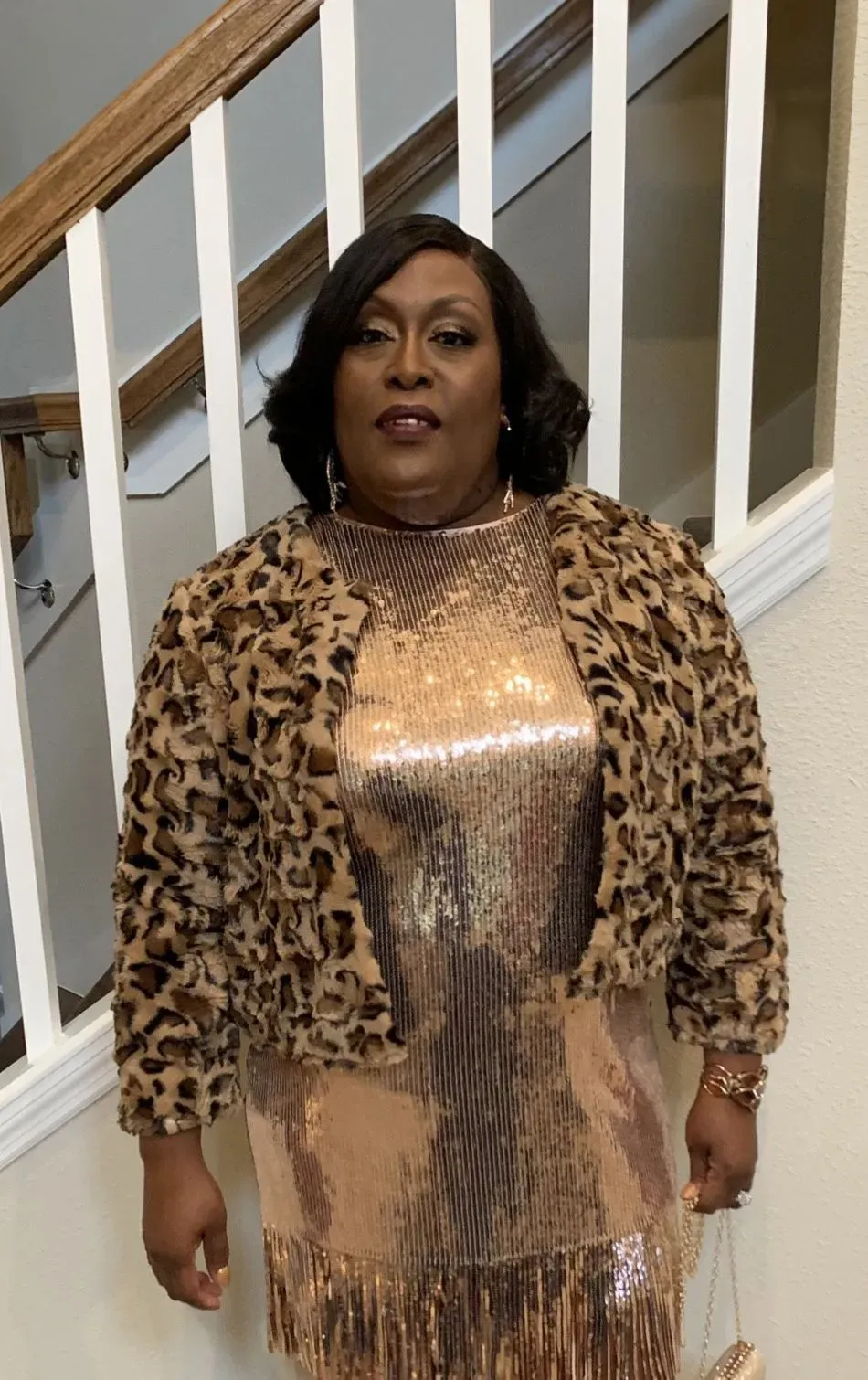 Before weight loss surgery