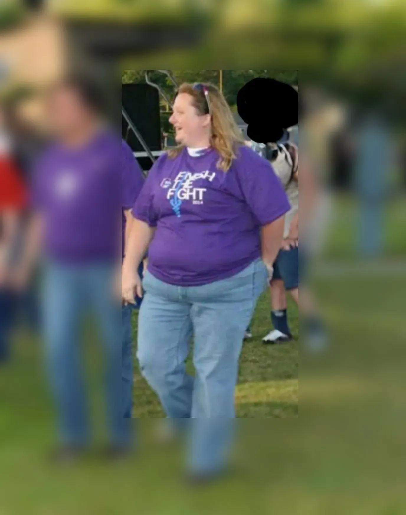 Before weight loss surgery