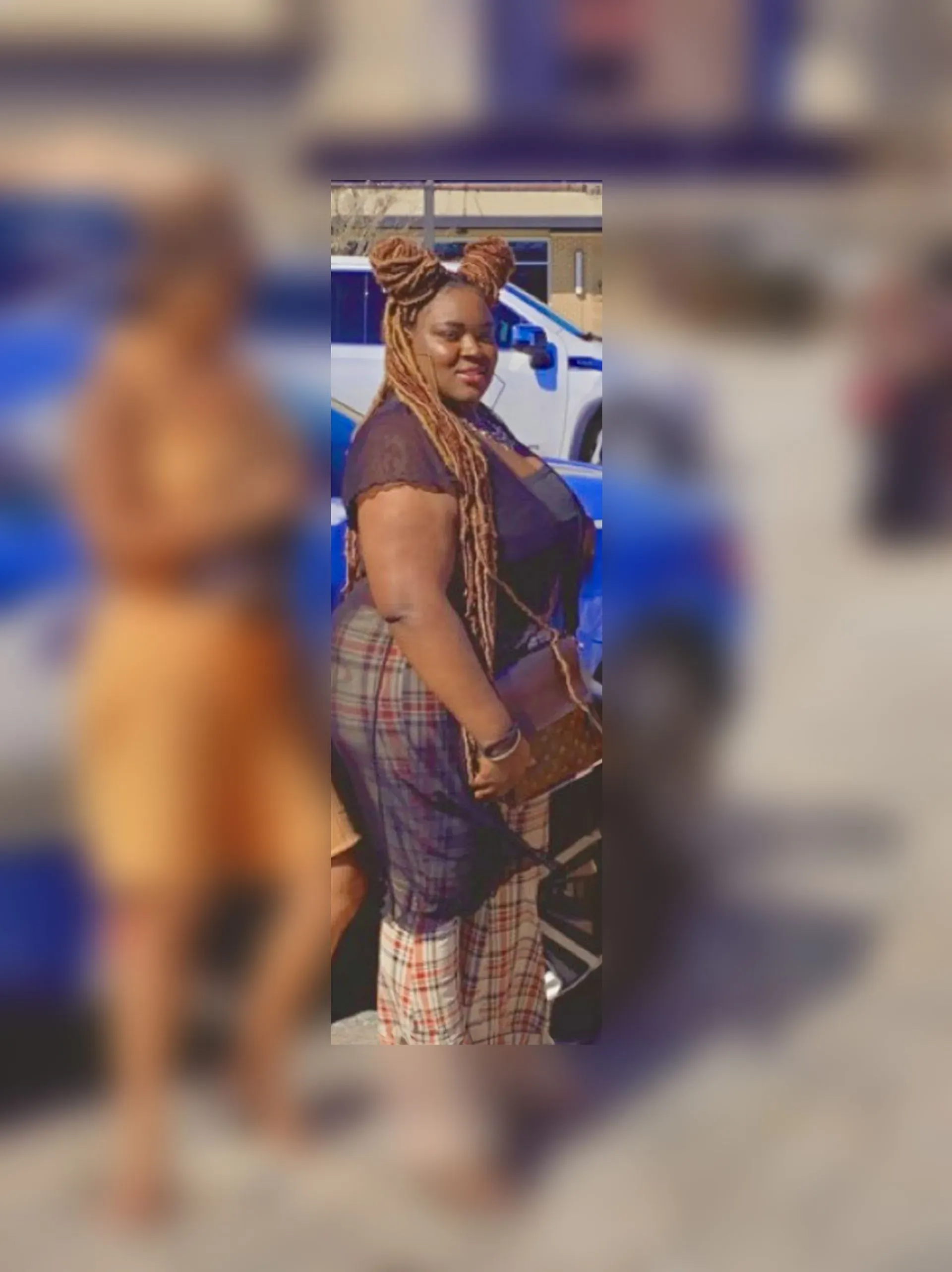 Before weight loss surgery