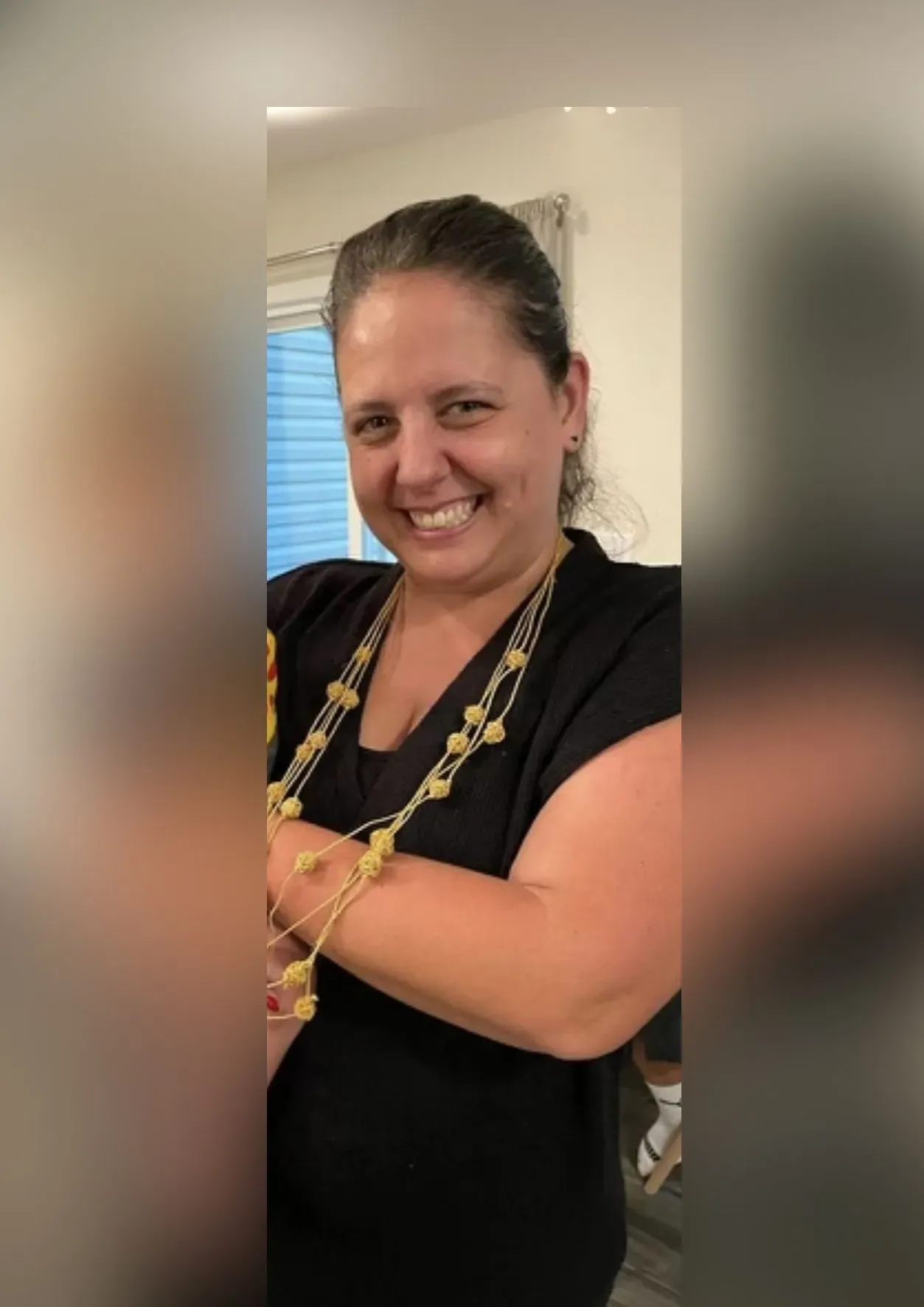 Before weight loss surgery