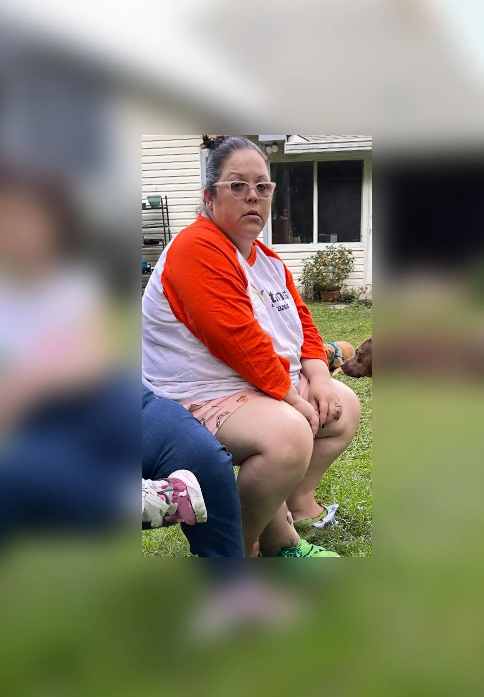 Before weight loss surgery