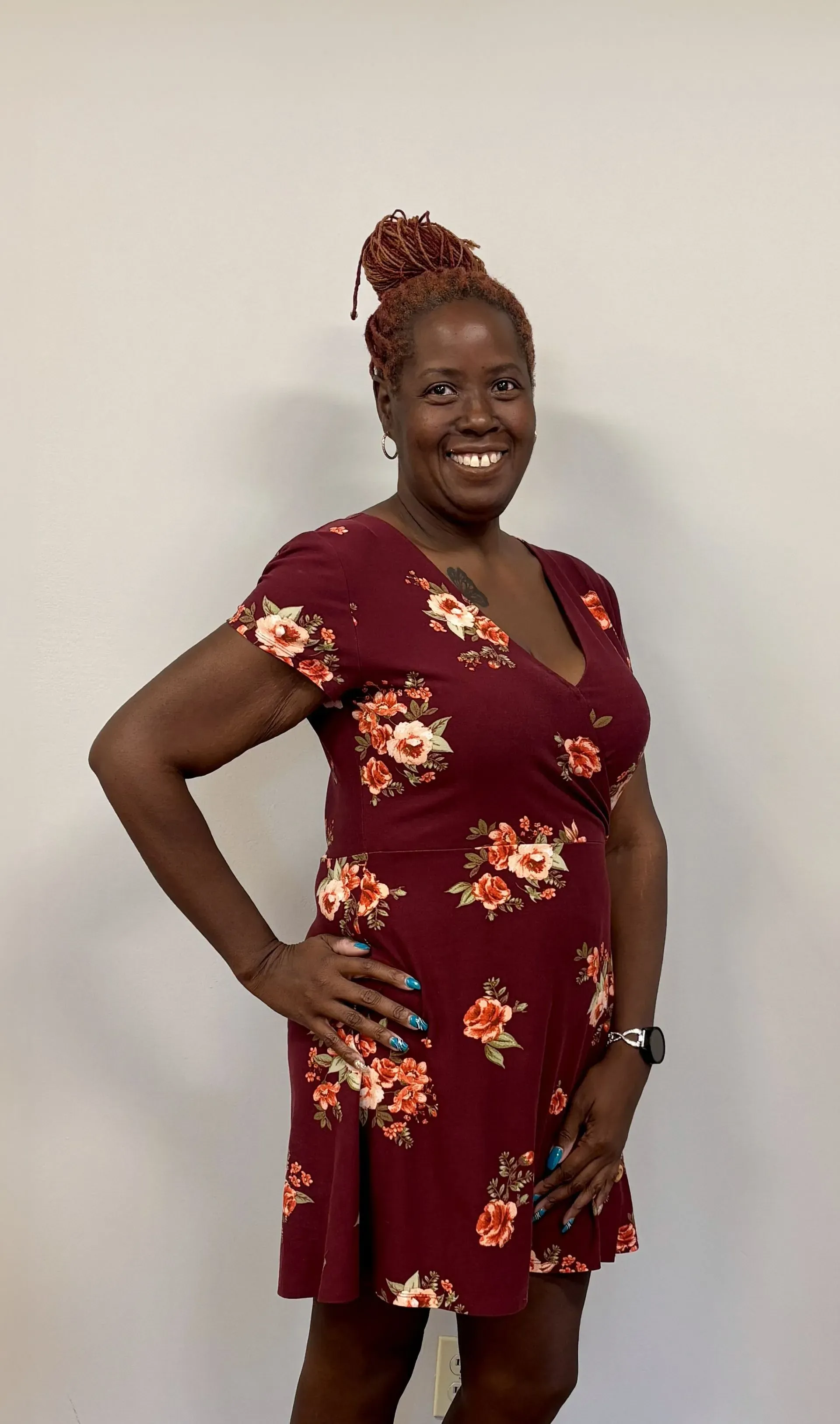 After weight loss surgery