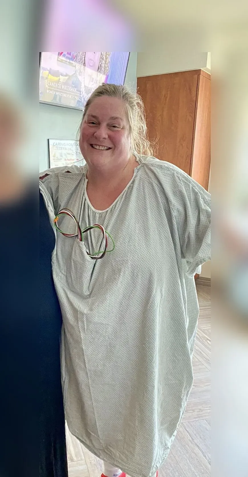 Before weight loss surgery