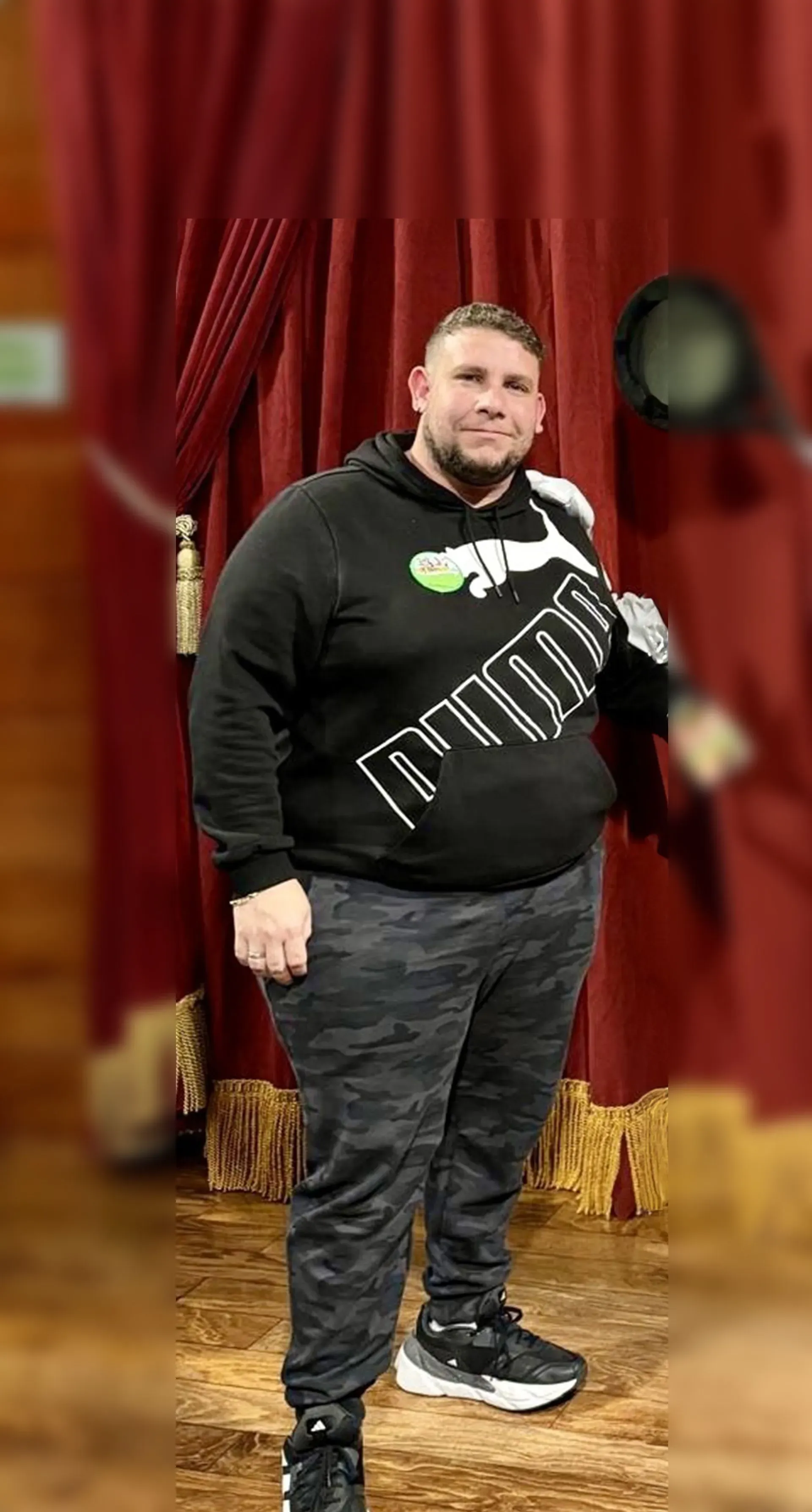 Before weight loss surgery