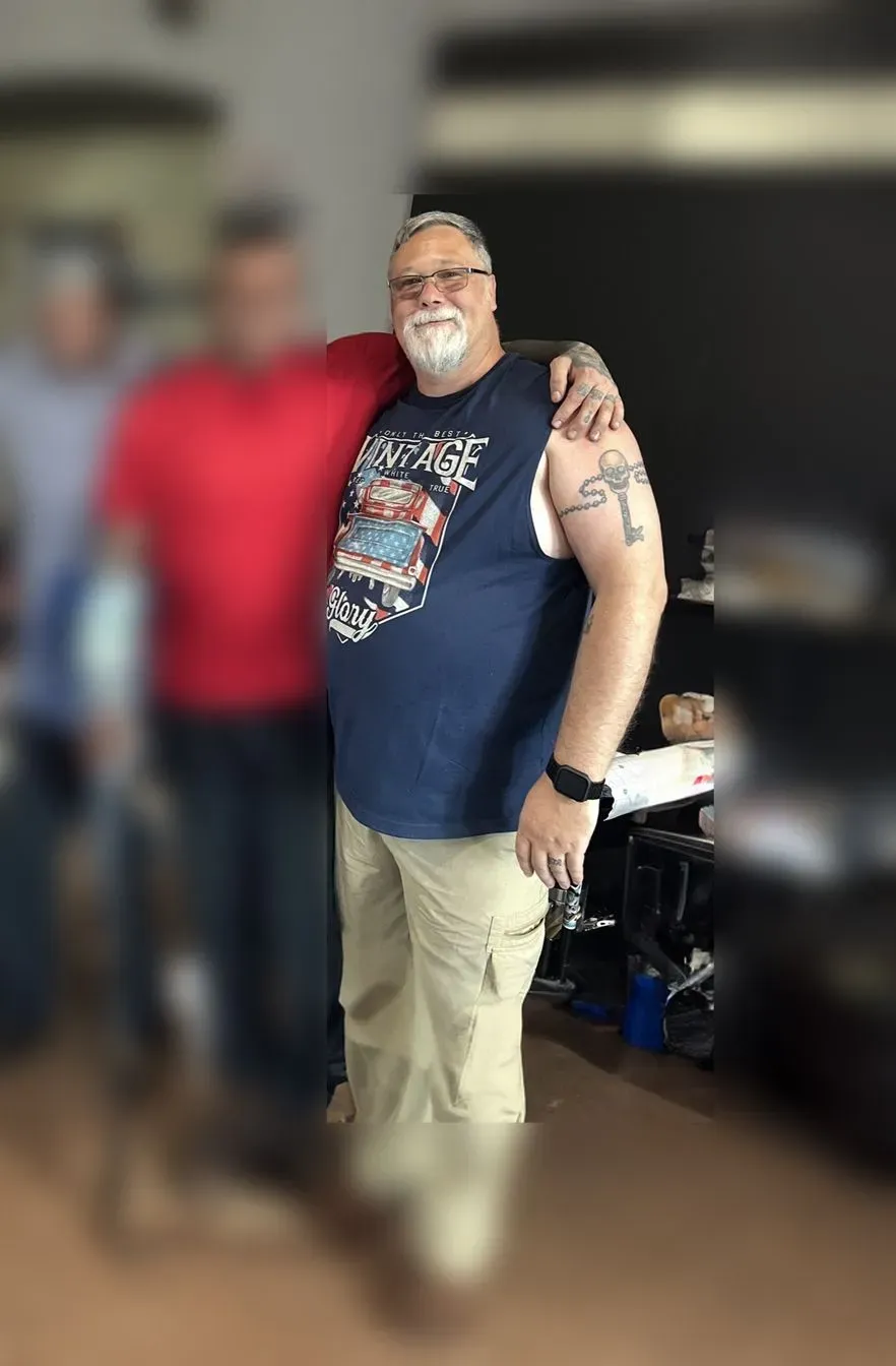 Before weight loss surgery