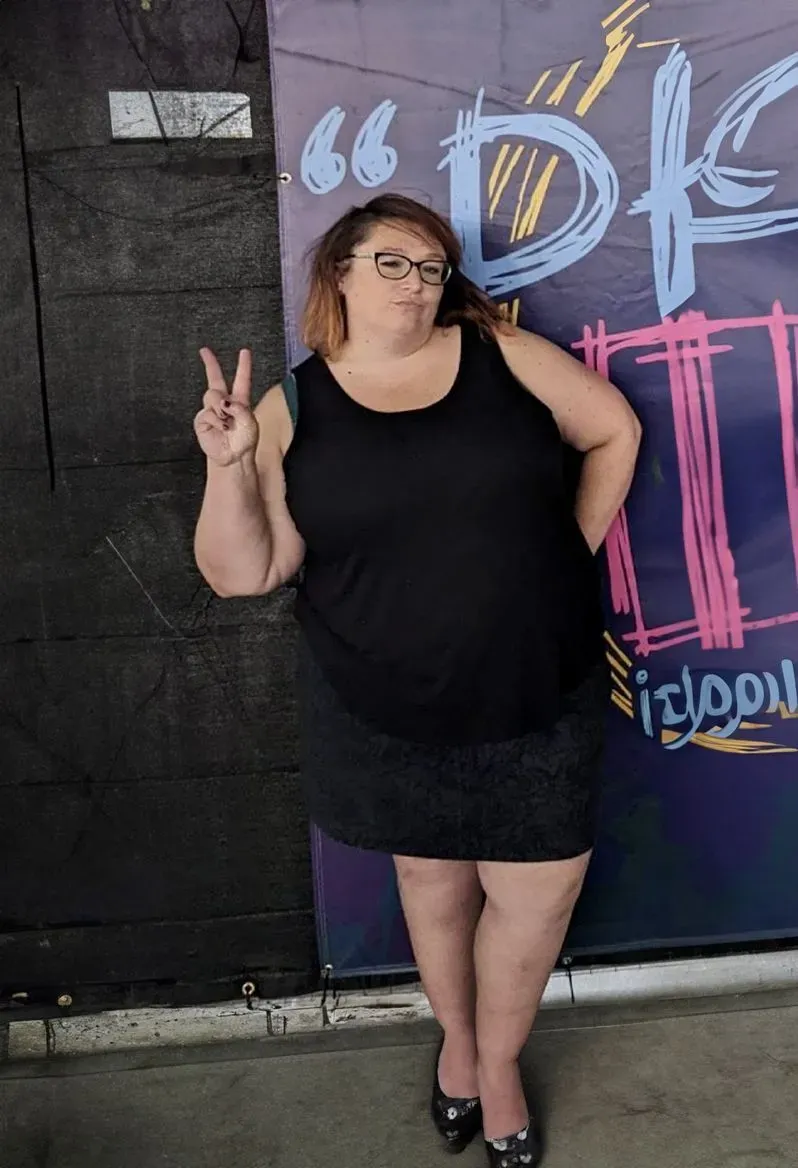 Before weight loss surgery