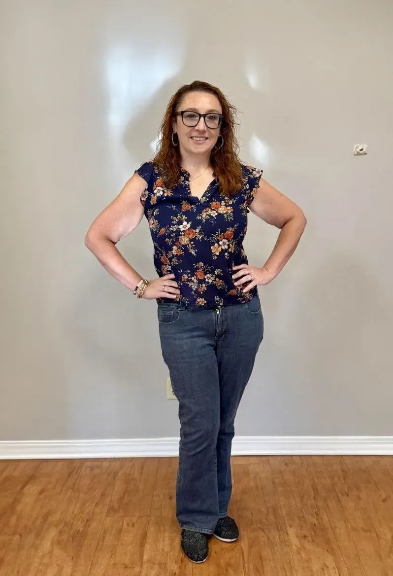 After weight loss surgery