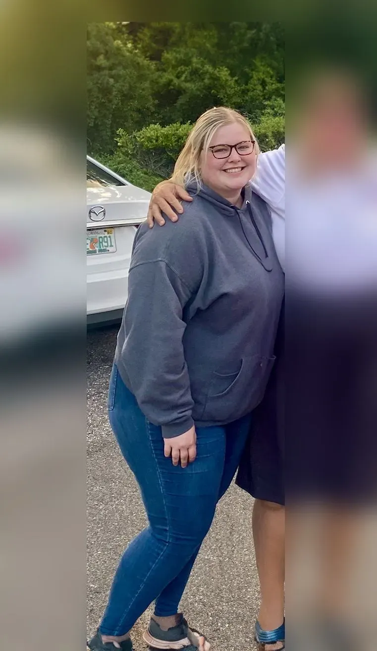 Before weight loss surgery