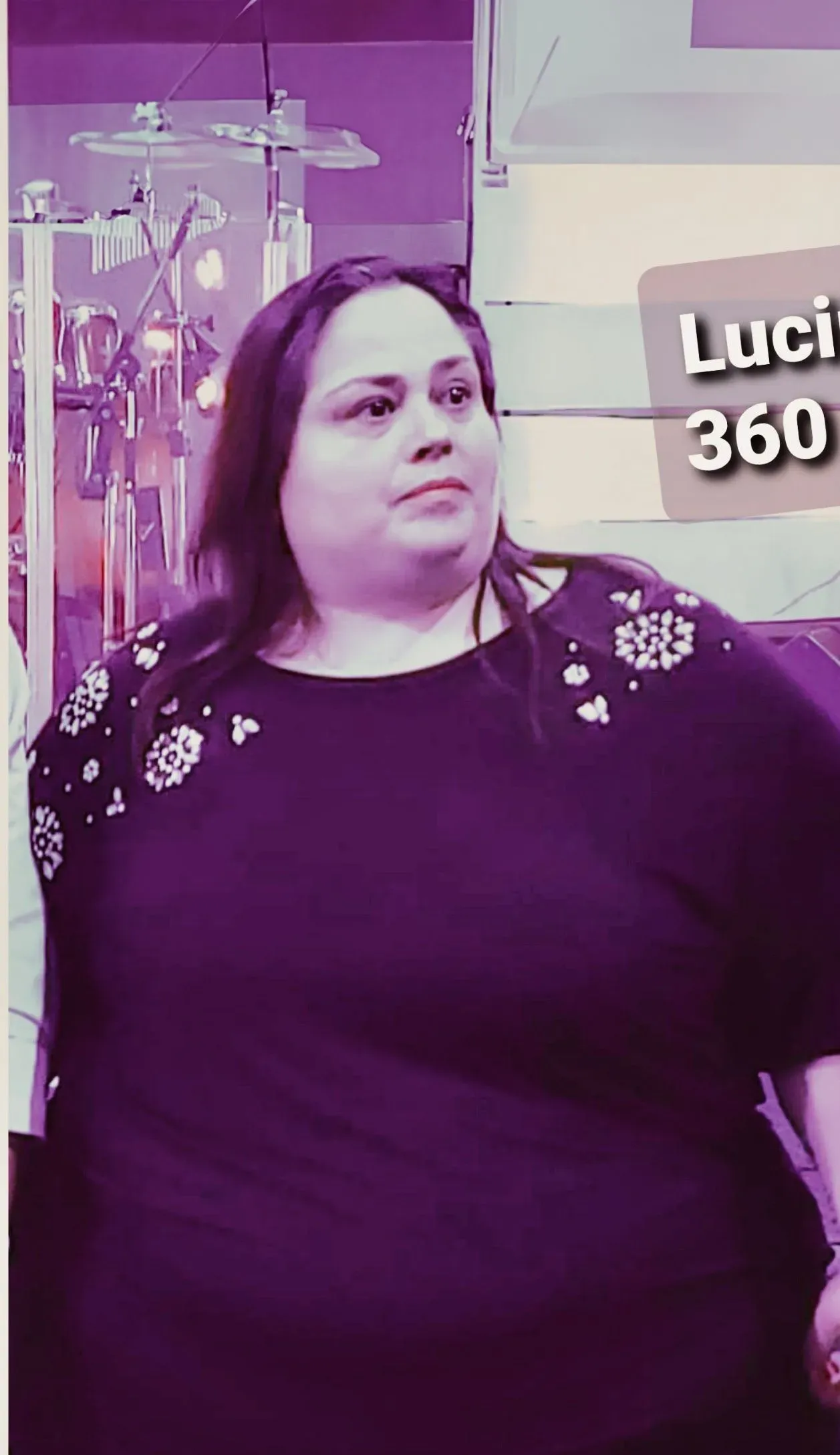 Before weight loss surgery