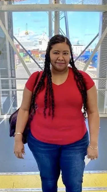 Before weight loss surgery