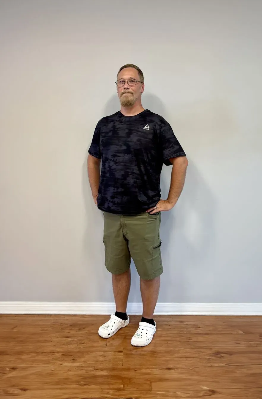 After weight loss surgery