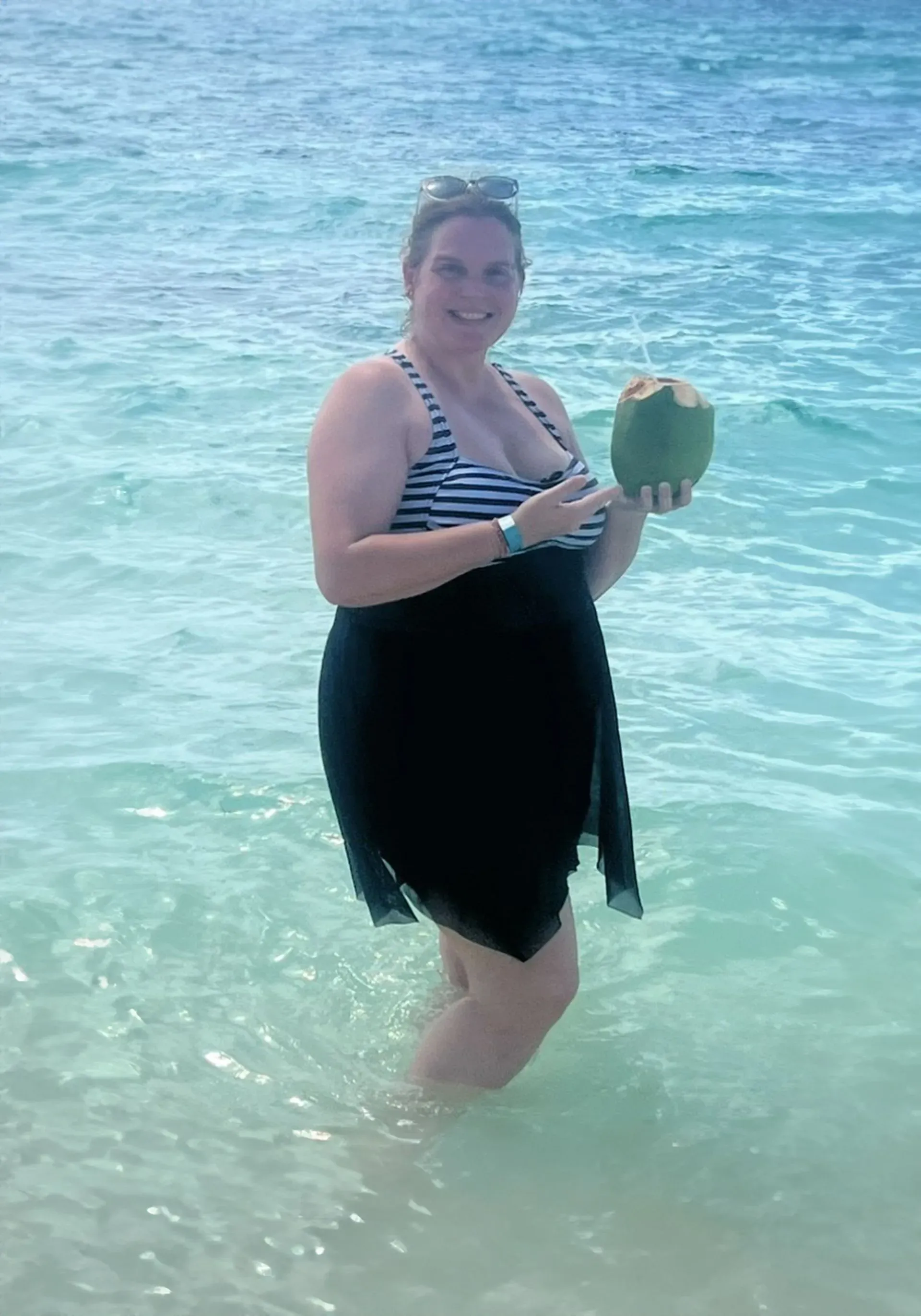 Before weight loss surgery