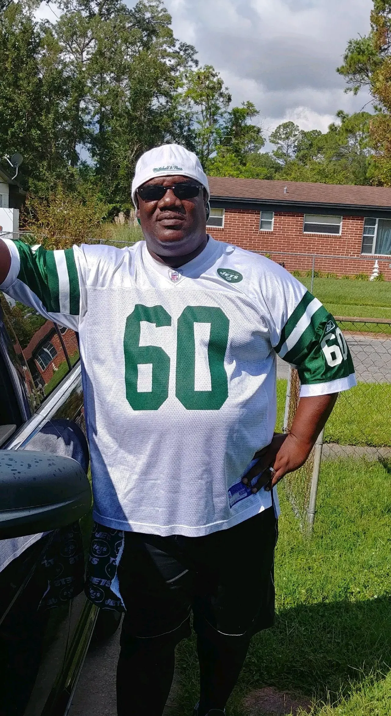 Before weight loss surgery