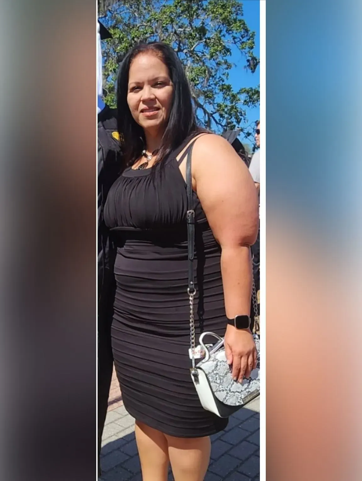 Before weight loss surgery