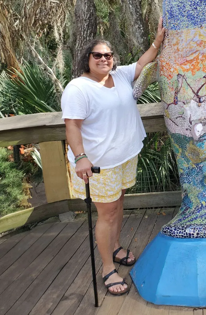 Before weight loss surgery