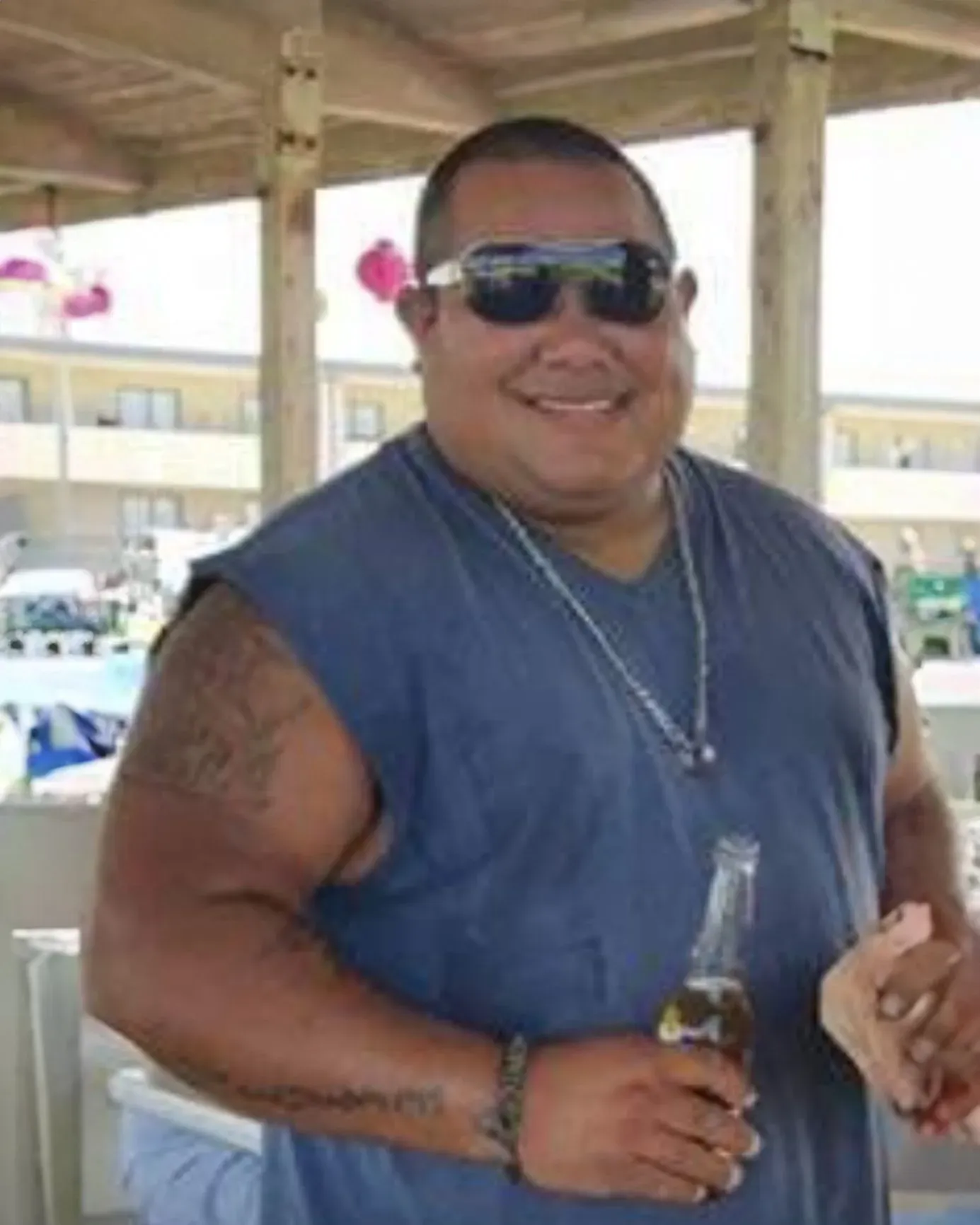 Before weight loss surgery