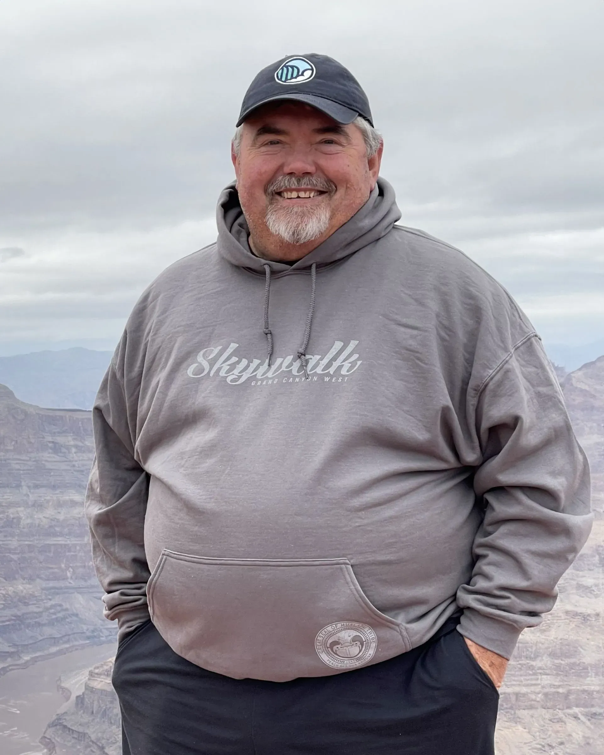 Before weight loss surgery