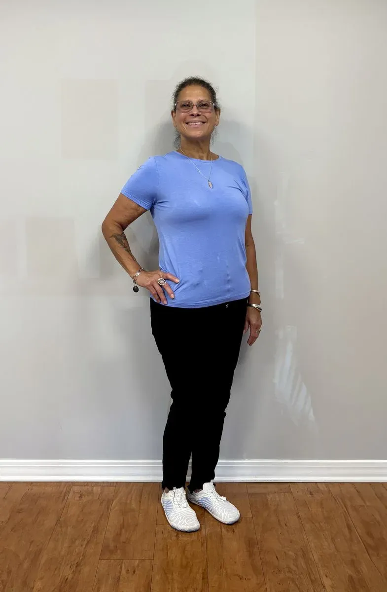 After weight loss surgery